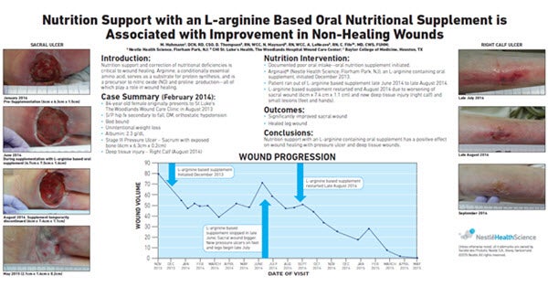 Nutrition Support with an L-arginine Based Oral Nutritional Supplement is Associated with Improvement in Non-Healing Wounds