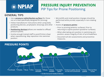 NPIAP – PIP Tips for Prone Positioning