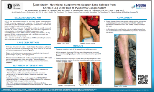 Wound Poster Pyoderma